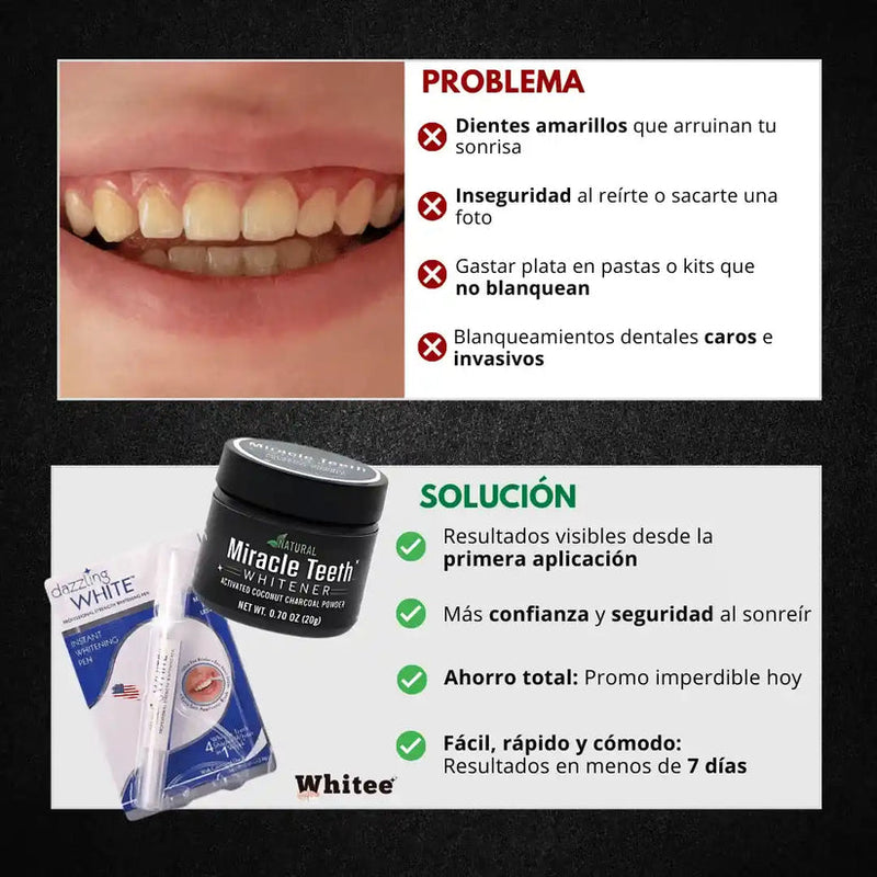 Blanqueador Dental Tiras Blanqueadoras